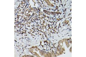 Immunohistochemistry of paraffin-embedded rat brain using PLP1 Rabbit pAb (ABIN7269724) at dilution of 1:100 (40x lens).