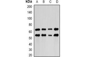 Western blot analysis of LIM expression in HepG2 (A), MCF7 (B), mouse lung (C), mouse kidney (D) whole cell lysates. (PDLIM5 anticorps)