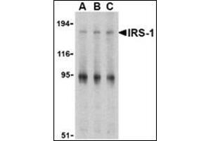 Western blot analysis of IRS-1 in PC-3 cell lysate with this product at (A) 1, (B) 2 and (C) 4 μg/ml. (IRS1 anticorps  (Center))
