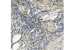 IHC analysis of Sprouty 4/Spry-4/SPRY4 using anti-Sprouty 4/Spry-4/SPRY4 antibody (ABIN7599232).