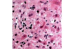 anti-Glycerol Kinase 1 (N-Term) antibody