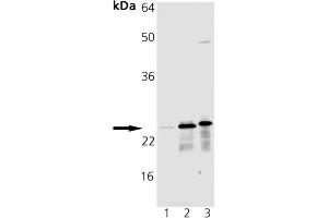 Western blot analysis of MnSOD pAb: Lane 1: HeLa Cell Lysate, Lane 2: Rat Brain Tissue Extract, Lane 3: Mouse Brain Tissue Extract (SOD2 anticorps)