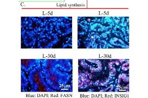 (A) Network of ceRNAs (lncRNA-mRNA) and miRNAs.