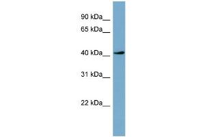 WB Suggested Anti-TSSK2  Antibody Titration: 0. (TSSK2 anticorps  (Middle Region))