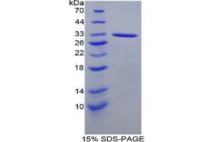SDS-PAGE analysis of Mouse ACP5 Protein. (ACP5 Protéine)