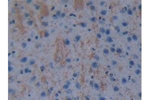 Detection of GSTt1 in Mouse Cerebrum Tissue using Polyclonal Antibody to Glutathione S Transferase Theta 1 (GSTt1)