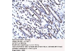 Human kidney (XRCC6 anticorps  (N-Term))