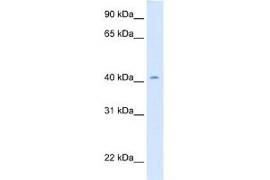 WB Suggested Anti-cad Antibody Titration:  0. (CAD anticorps  (Middle Region))