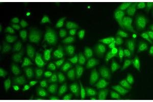 Immunofluorescence analysis of HeLa cells using AKR1A1 Polyclonal Antibody (AKR1A1 anticorps)