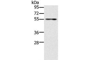 Western Blot analysis of Mouse intestinum tenue tissue using PUS10 Polyclonal Antibody at dilution of 1:200 (PUS10 anticorps)