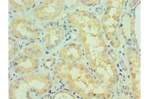 Immunohistochemistry of paraffin-embedded human kidney tissue using ABIN7145333 at dilution of 1:100 (TRKB anticorps  (AA 32-282))