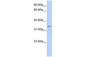 Tenomodulin antibody used at 1 ug/ml to detect target protein. (TNMD anticorps  (N-Term))