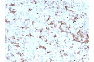 Formalin-fixed, paraffin-embedded human Pituitary stained with Prolactin Mouse Monoclonal Antibody (PRL/2641). (Prolactin anticorps  (AA 63-201))