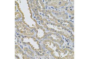 Immunohistochemistry of paraffin-embedded human kidney using PPID Antibody (ABIN5974177) at dilution of 1/100 (40x lens). (PPID anticorps)