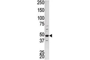 Western blot analysis of PCTAIRE1 antibody and HepG2 lysate
