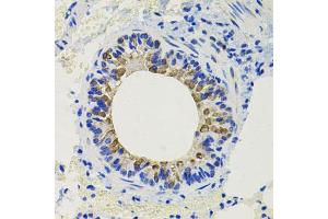 Immunohistochemistry of paraffin-embedded mouse lung using CALB2 antibody. (Calretinin anticorps)