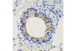 Immunohistochemistry of paraffin-embedded mouse lung using CALB2 antibody.
