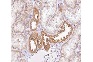 ABIN6266891 at 1/100 staining human kidney tissue sections by IHC-P. (NRIP2 anticorps  (N-Term))