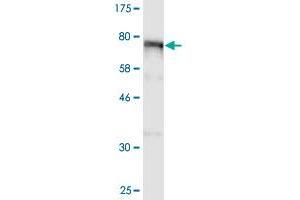 Western Blot detection against Immunogen (98. (ALOX15 anticorps  (AA 1-662))