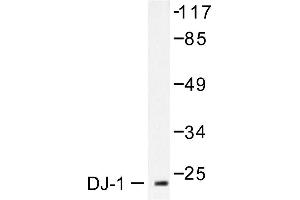 Image no. 1 for anti-Parkinson Protein 7 (PARK7) antibody (ABIN265384) (PARK7/DJ1 anticorps)