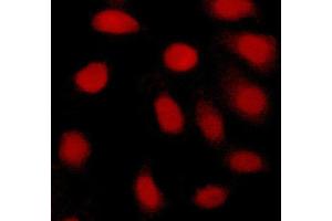 ABIN6269077 staining Hela cells by ICC/IF.