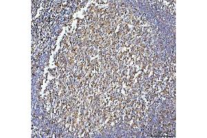 IHC analysis of CD86 using anti-CD86 antibody (ABIN3042788).