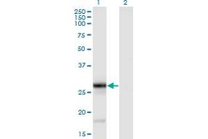Western Blot analysis of TNFSF9 expression in transfected 293T cell line by TNFSF9 monoclonal antibody (M01), clone 1D7.
