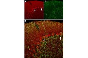 Expression of HCN2 in rat cerebellumImmunochistochemical staining of rat cerebellum frozen sections using Anti-HCN2 Antibody (ABIN7043279, ABIN7044940 and ABIN7044941 ).