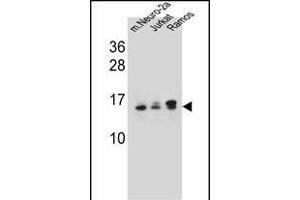 UBE2E2 Antibody (N-term) (ABIN657745 and ABIN2846729) western blot analysis in mouse Neuro-2a,Jurkat,Ramos cell line lysates (35 μg/lane).