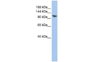 RNF20 antibody used at 1 ug/ml to detect target protein. (RNF20 anticorps  (N-Term))