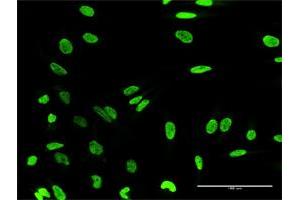 Immunofluorescence of purified MaxPab antibody to HN1L on HeLa cell. (HN1L anticorps  (AA 1-190))
