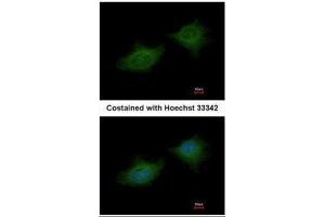 ICC/IF Image Immunofluorescence analysis of methanol-fixed HeLa, using MMP3, antibody at 1:200 dilution. (MMP3 anticorps)