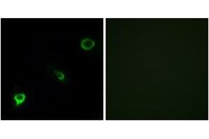 Immunofluorescence analysis of COS7 cells, using TYK2 (Ab-1054) Antibody. (TYK2 anticorps  (AA 1020-1069))