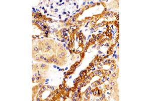 (ABIN6242941 and ABIN6578201) staining KIF22 in human kidney tissue sections by Immunohistochemistry (IHC-P - paraformaldehyde-fixed, paraffin-embedded sections).