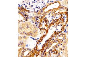 (ABIN6242941 and ABIN6578201) staining KIF22 in human kidney tissue sections by Immunohistochemistry (IHC-P - paraformaldehyde-fixed, paraffin-embedded sections). (KIF22 anticorps  (AA 423-456))