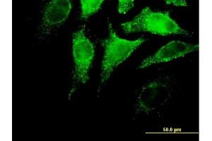 Immunofluorescence of purified MaxPab antibody to IFNA4 on HeLa cell.