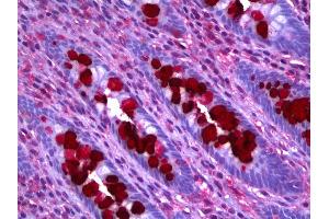 Anti-CLCA1 antibody IHC of human colon, goblet cells.