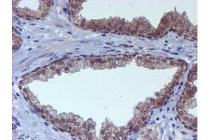 anti-RuvB-Like 2 (E. Coli) (RUVBL2) (AA 113-370) antibody