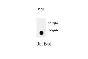 Dot blot analysis of anti-Phospho-IRS2-p Antibody (ABIN389979 and ABIN2839769) on nitrocellulose membrane. (IRS2 anticorps  (pTyr978))