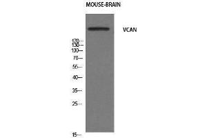 Western Blotting (WB) image for anti-Versican (Vcan) (N-Term) antibody (ABIN3187467) (Versican anticorps  (N-Term))