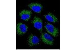 Confocal immunofluorescent analysis of Glutathione reductase Antibody (C-term) Cat.