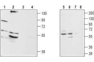 Western blot analysis of rat brain stem (lanes 1 and 3), mouse brain (lanes 2 and 4), SH-SY5Y (lanes 5 and 7) and Jurkat (lanes 6 and 8) lysates: - 1,2,5,6.