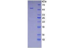 SDS-PAGE of Protein Standard from the Kit (Highly purified E. (ICAM1 Kit CLIA)