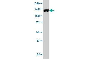 UBE4B monoclonal antibody (M01), clone 8F9 Western Blot analysis of UBE4B expression in Hela S3 NE .