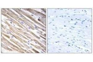 Immunohistochemistry analysis of paraffin-embedded human heart tissue using RPL3L antibody.