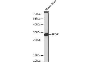Western blot analysis of extracts of Mouse brain, using PROP1 Rabbit pAb (ABIN7269568) at 1:1000 dilution. (PROP1 anticorps  (AA 50-150))