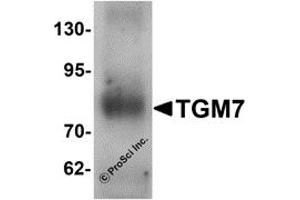 Western Blotting (WB) image for anti-Transglutaminase 7 (TGM7) antibody (ABIN1077363)