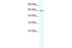 WB Suggested Anti-TRIM3 Antibody Titration:  1.