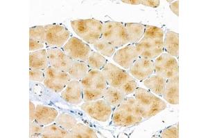 Immunohistochemistry of paraffin embedded mouse skeletal muscle using ATP2A2 (ABIN7075545) at dilution of 1: 500 (400x lens) (SERCA2 ATPase anticorps)