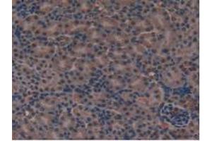 IHC-P analysis of Mouse Kidney Tissue, with DAB staining. (FLT4 anticorps  (AA 30-326))